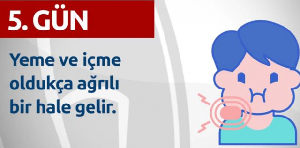 Gün Gün Corona Virüs Belirtileri Açıklandı 8