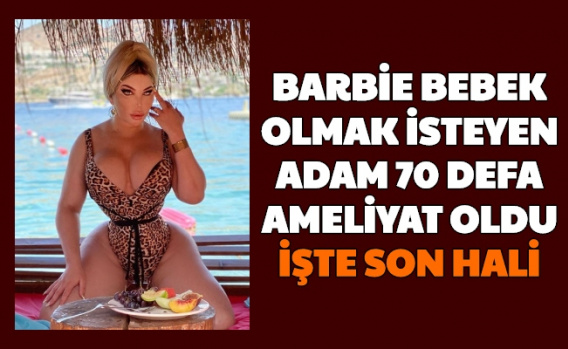 Barbie Bebek Olmak İsteyen Adam 70 Defa Ameliyat Oldu-İşte Son Hali 1