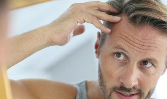 Uzmanından saç ekimine dair 6 maddede doğru bilinen yanlışlar