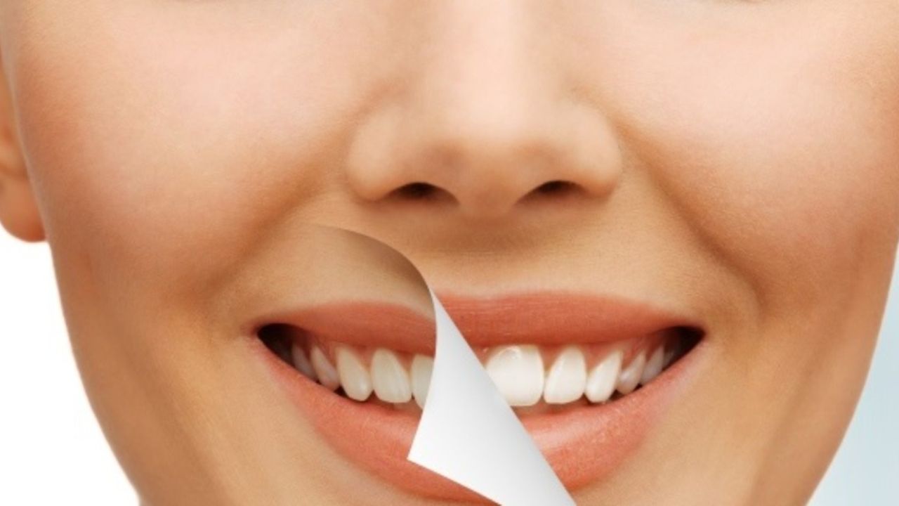 Evde bembeyaz dişlere sahip olmak bu kadar kolay! Düzenli yapanın dişleri inci gibi olacak