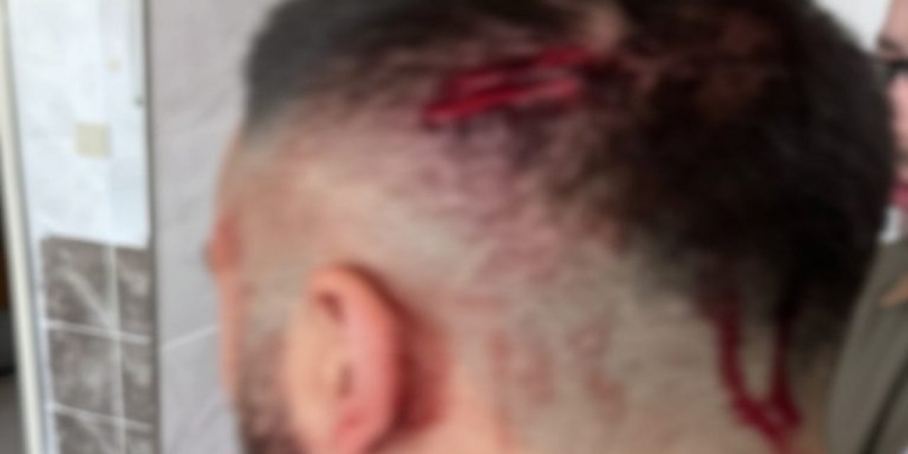 Şanlıurfa'da Öğretmene Veli Vahşeti: Sopalı Saldırgan Tutuklandı