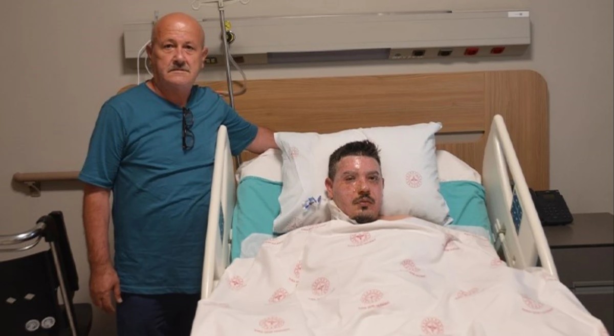 Türkiye'yi istila ettiler! Karşısına kim çıkarsa ısırıp bırakıyor
