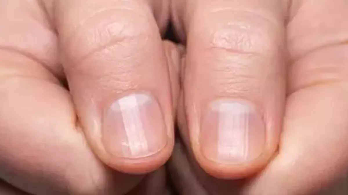 parmaklarda ve tırnaklarda meydana gelen değişiklikler hastalık habercisi